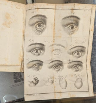 Traite Pratique des Maladies des Yeux, ou Experiences et Observations sur les Maladies qui Affectent ces Organs, 2 vol.