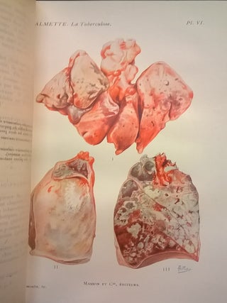 L'Infection Bacillaire et la Tuberculose Chez l'Homme et Chez Animaux