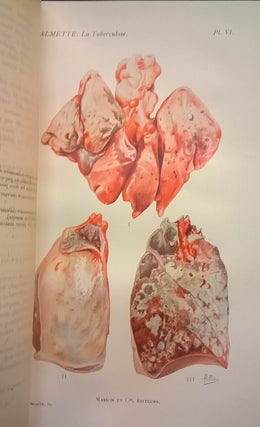 L'Infection Bacillaire et la Tuberculose Chez l'Homme et Chez Animaux