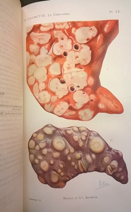 L'Infection Bacillaire et la Tuberculose Chez l'Homme et Chez Animaux